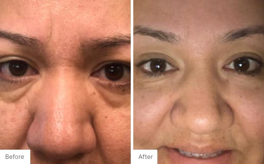 8 - Before and After Real Results photo of a woman's face.